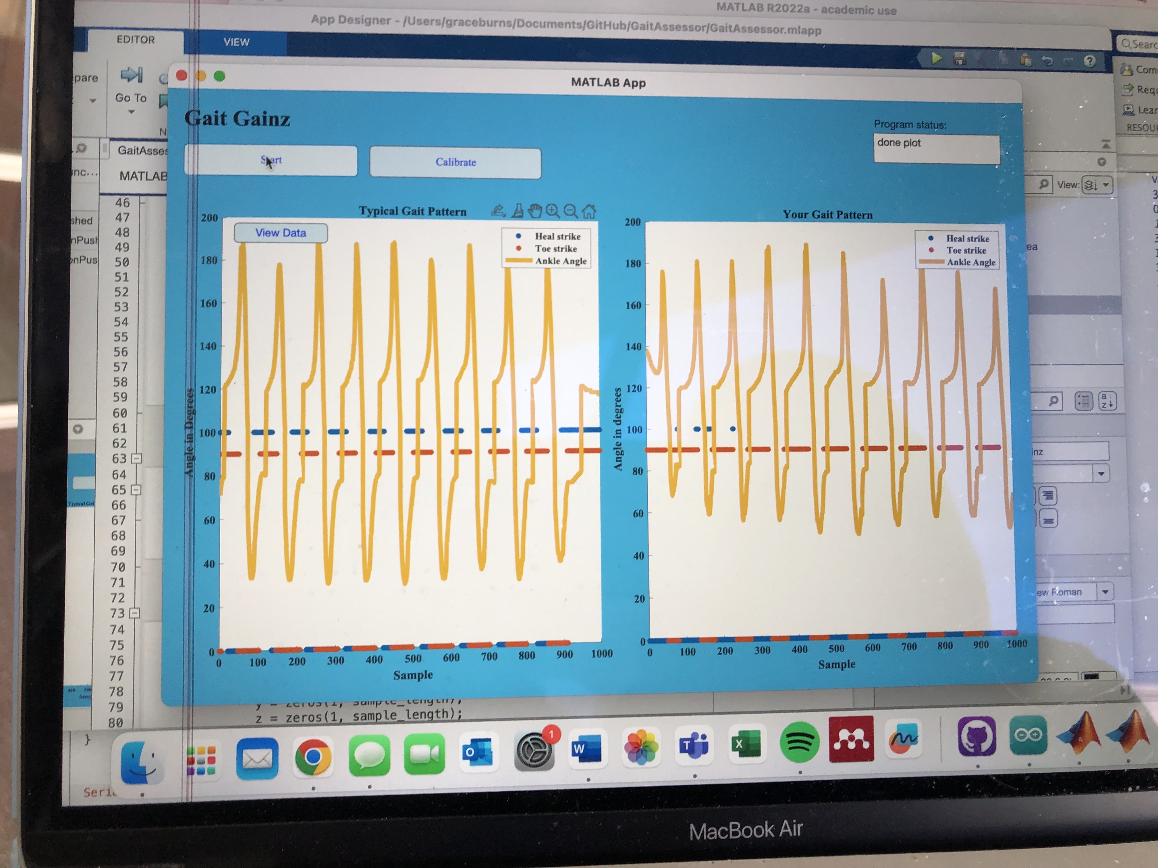 GaitAssessor_Building_the_UI