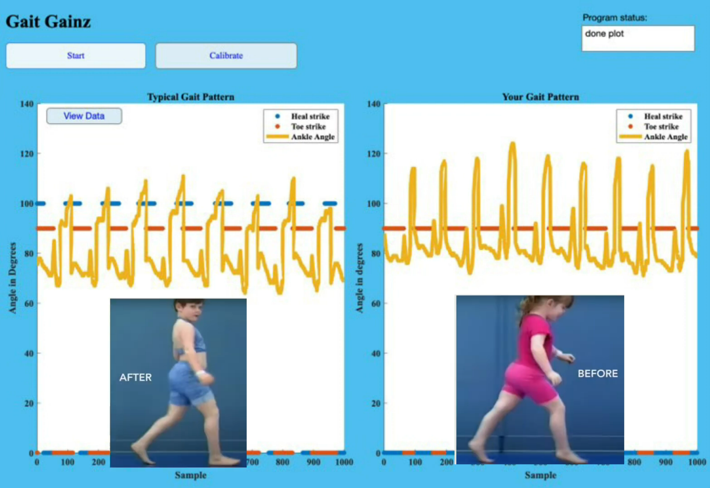 GaitAssessor_Gait_Patterns