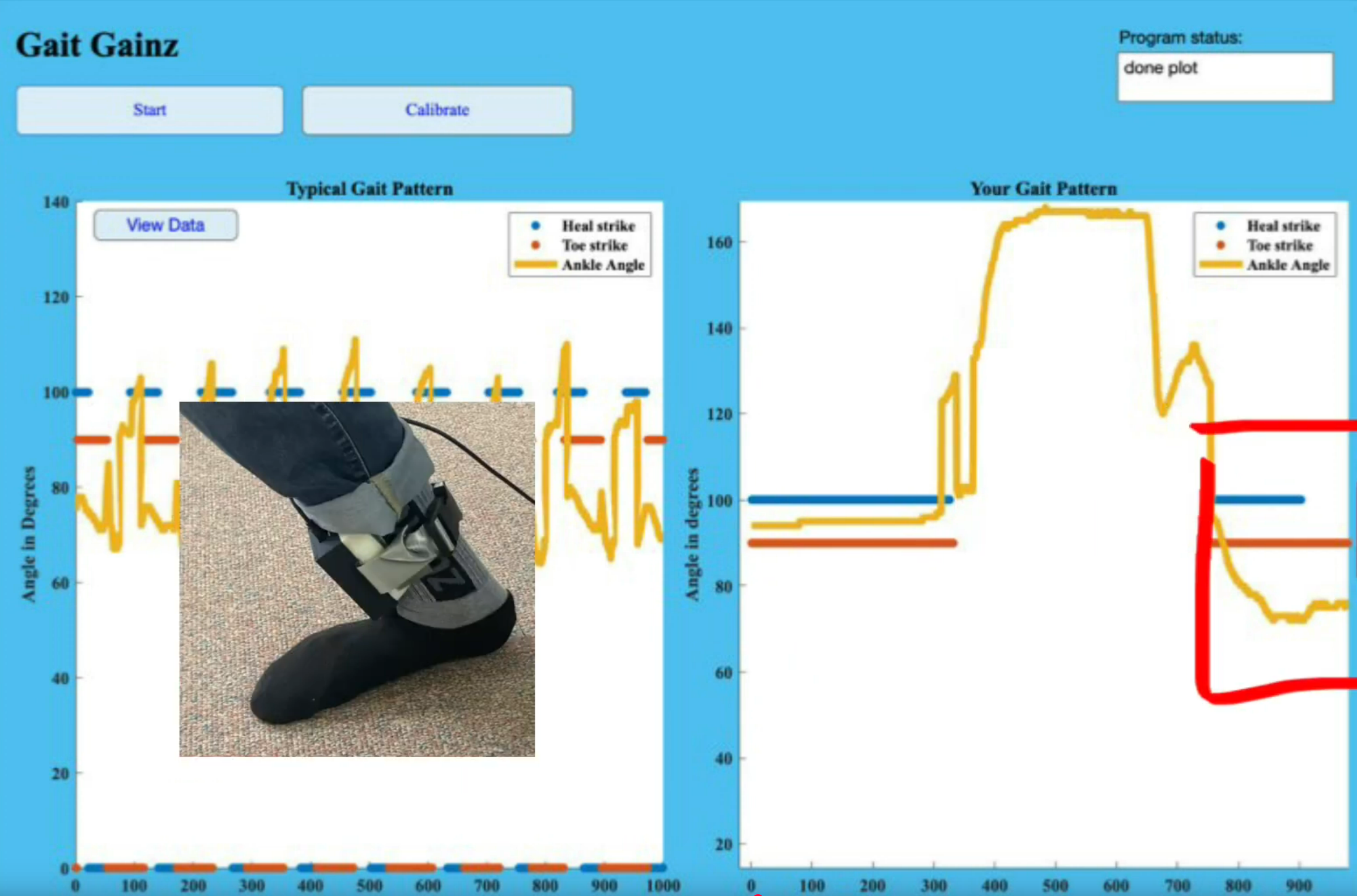 GaitAssessor_UI_vs_Foot_Position
