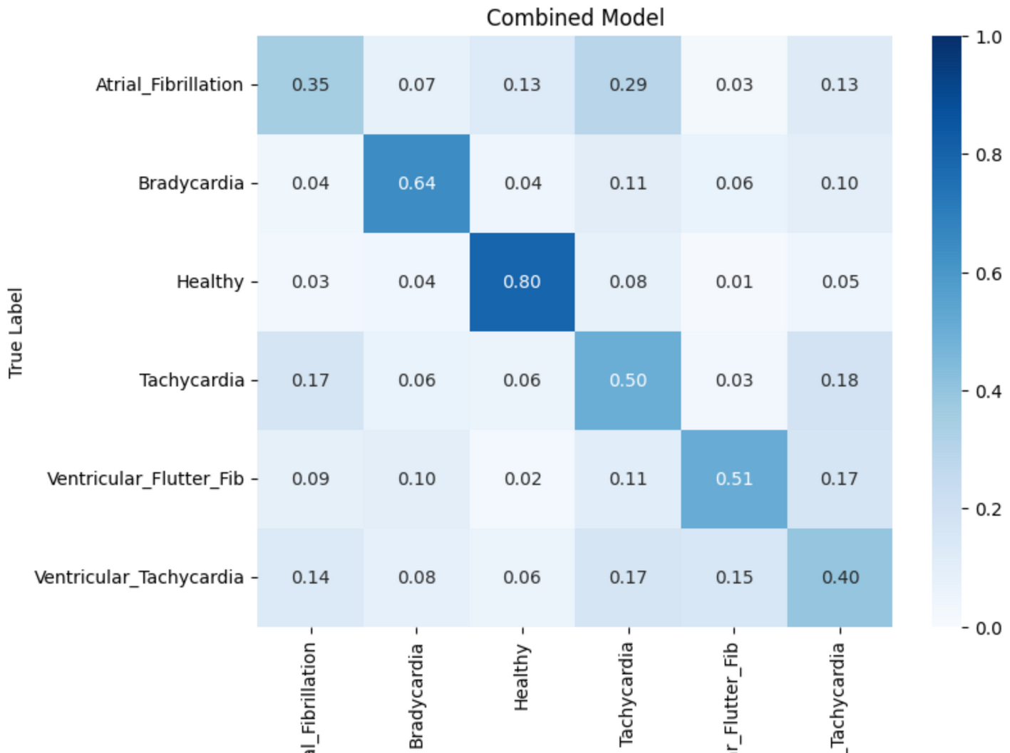 RhythmGuard_Confusion_Matrix